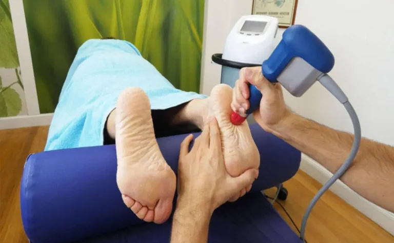 Ondas de choque en fascitis plantar ¿realmente funcionan?